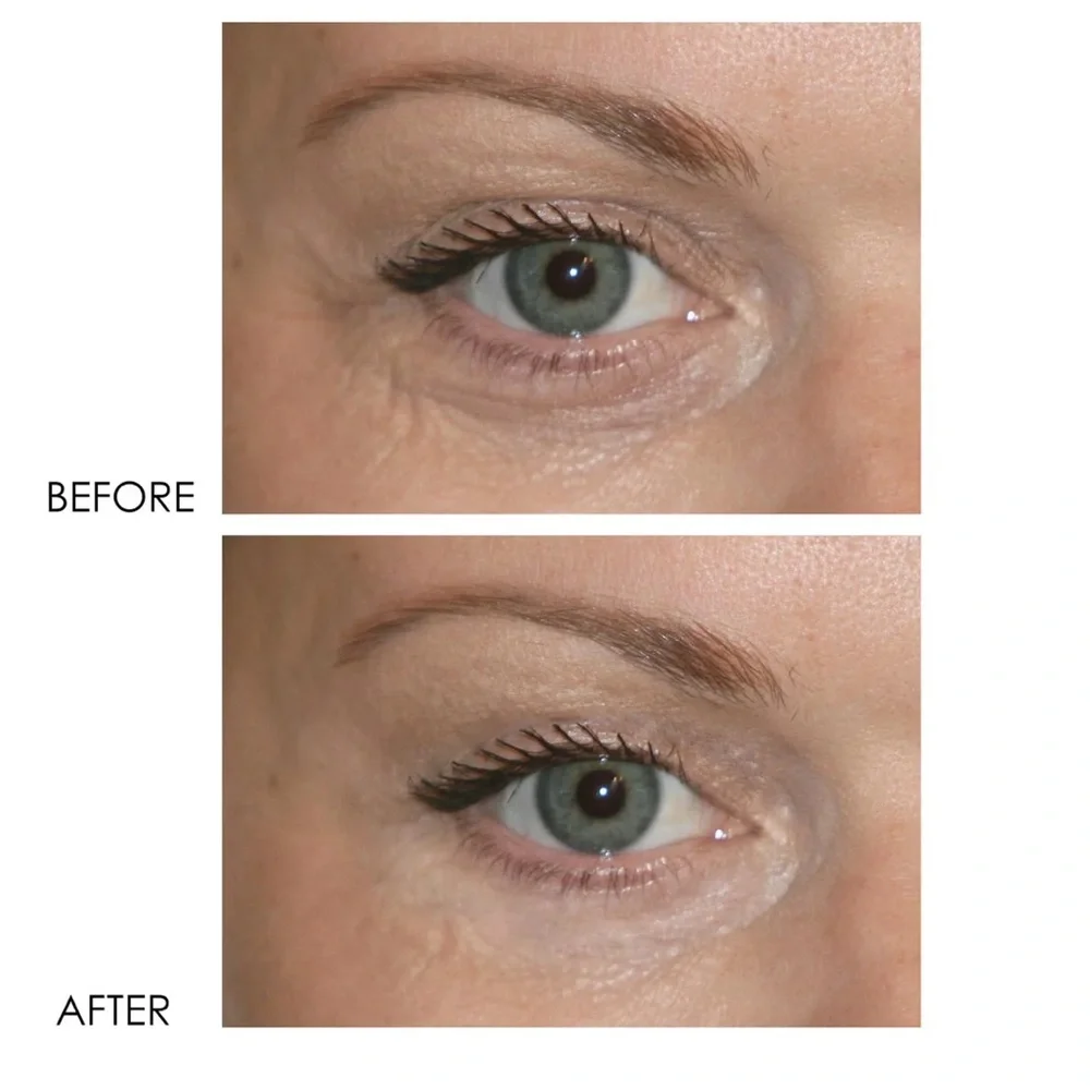 DERMELECT COSMECEUTICALS Revitalite Professional Eyelid & Dark Circle Corrector